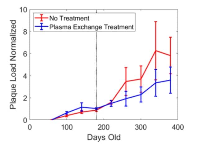 Dr. Oscar Lopez therapeutic plasma exchange results line graph